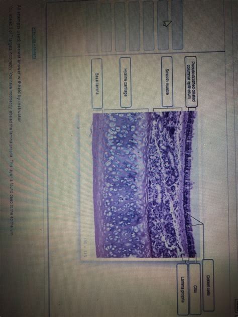 Solved Goblet Cells Cilta Pseudotrauifled Ciliated Columnar Chegg Com