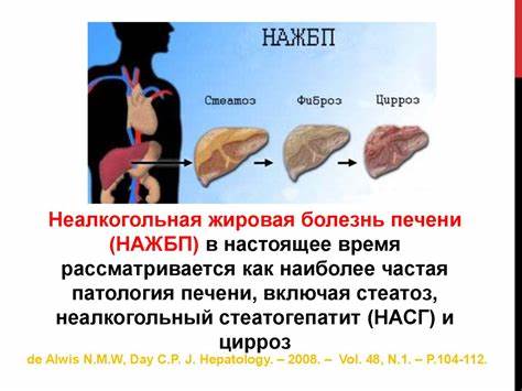 Диета болезнь печени Неалкогольная жировая болезнь печени - презентация онлайн Неалкогольная жировая болезнь печени - презентация онлайн Диета болезнь печени