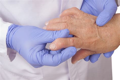 7 Common Mistakes Of Rheumatoid Arthritis Medication Patientsengage