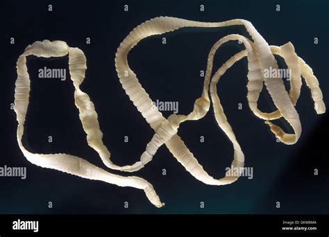 Tapeworm Taenia Solium Portugal Stock Photo 115386554 Alamy