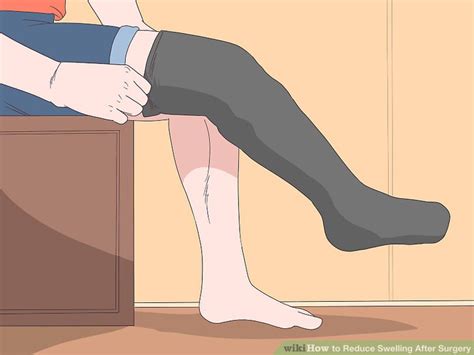 3 Ways To Reduce Swelling After Surgery Wikihow