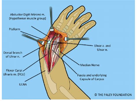 Flexor Tendons Wrist Anatomy Diagram