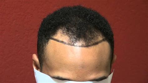 Black Men Hair Growth Spefashion
