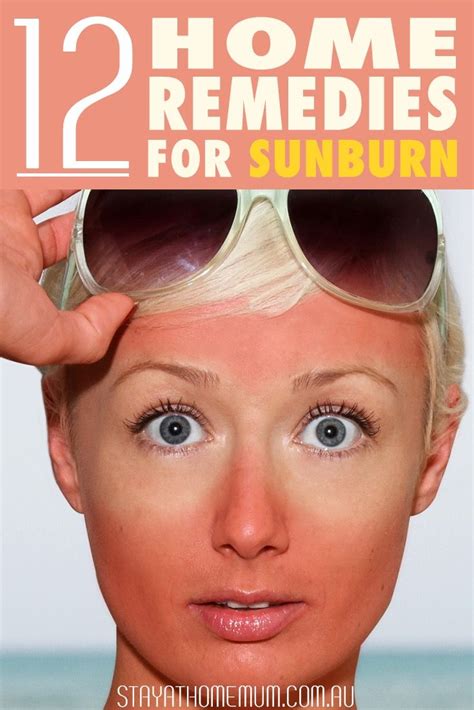 Sunburn Blisters Get Rid Of Sunburn Sunburnt Face Remedy Face