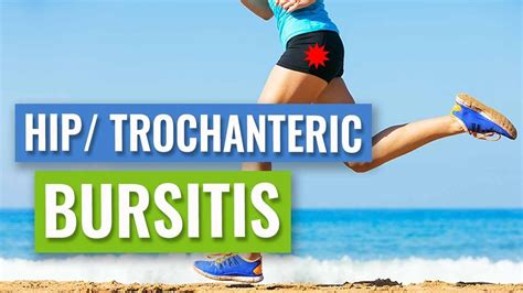 Lateral Hip Or Trochanteric Bursitis Causes And Treatment Youtube