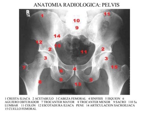 Anatomía Radiológica De Pelvis Y Abdomen Pelvis