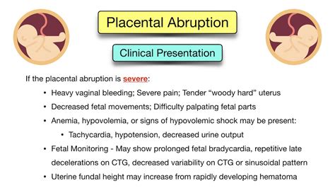 Placental Abruption Symptoms Causes Treatment Types Ultrasound