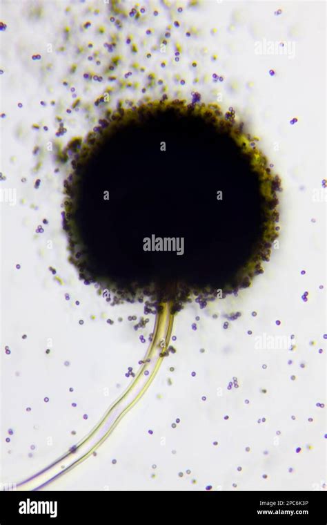 Microscopic View Of A Conidial Head Of Black Mold Aspergillus Niger