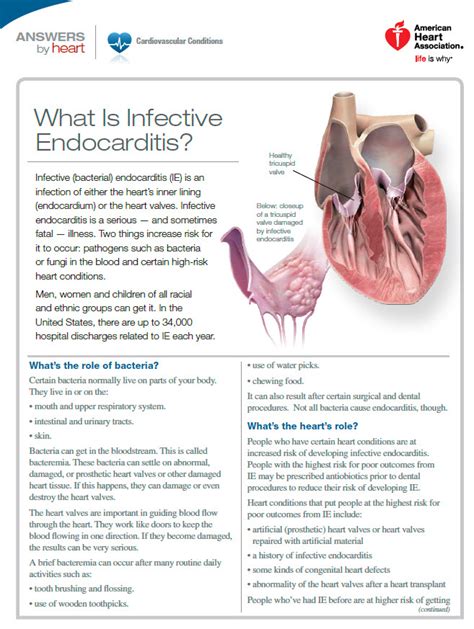 Cardiovascular disease (cvd) is a general term for conditions affecting the heart or blood vessels. Heart Valves and Infective Endocarditis | Go Red for Women
