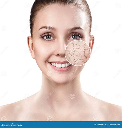 Zoom Circle Shows Facial Skin Before Moistening Stock Photo Image Of