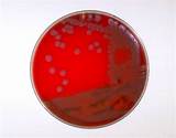 Images of Blood Agar Plate