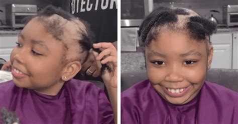 Brave Girl With Alopecia Takes Charge Of Her Unexpected Hair Loss Im