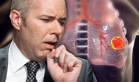 Lung Cancer Symptoms Signs Of Tumour You Need Treatment Include A Bad