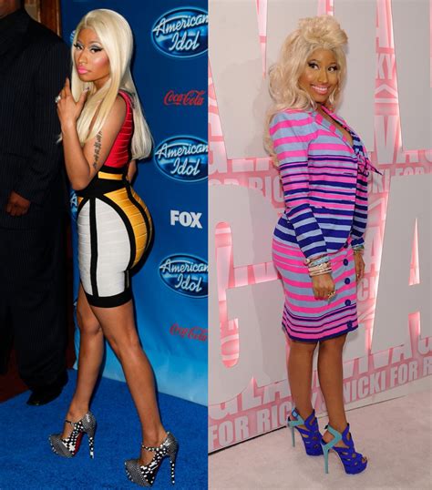 Nicki Minaj Breast Implants Plastic Surgery Boobs Job Before And After