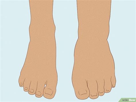 How To Treat Trench Foot Symptoms And Causes With Pictures