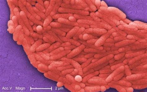 From food and animal faeces 5 ed june 2010. La salmonela entérica Typhimurium es el serotipo de ...