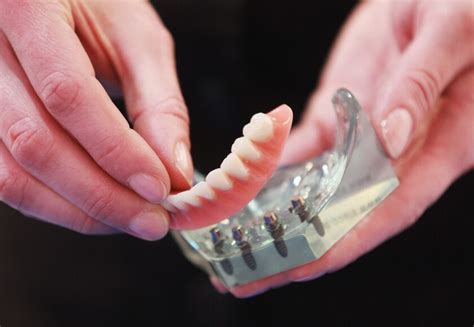 Missing Dentures Found Stuck In Throat 8 Days After Surgery Los Angeles Times