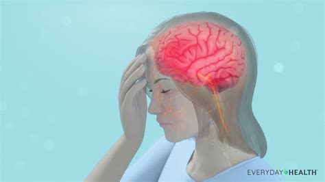 Parts Of Brain Headache Human Anatomy