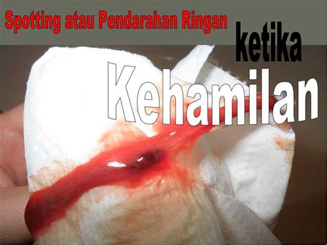 Keputihan yang bercampur darah tersebut dapat berarti beberapa hal, tidak selalu kanker serviks, walaupun tetap tidak menutup kemungkinan akan hal tersebut. Kurus Cantik Sihat Bersama Mama Ija: Spotting Atau ...
