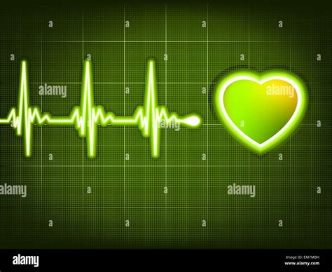 Resumen Latidos Del Corazón Electrocardiograma Realizado 8 Eps Imagen