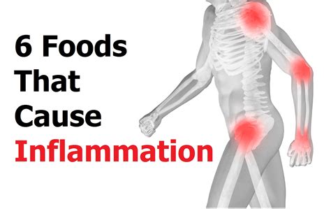 6 Foods That Cause Inflammation In Your Body Faculty Of Medicine