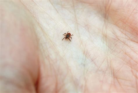How To Remove An Embedded Tick Without Tweezers Howotremvo