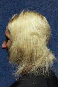 This imparts a uniform blonde or white look to your hair, based on how long you leave the bleach mix. That fried hair though | Beard growth oil, Growth oil ...