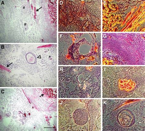 Teratoma Formation In Nude Mice Ac Histological Sections Of Tumors My