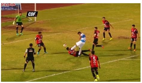 Terrible Patada En El Fútbol Chileno Traumatismo De Cráneo Y Diversas