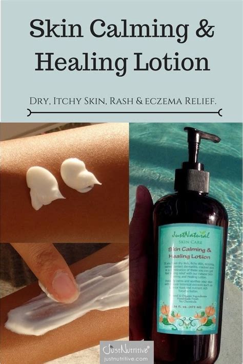If You Have Dry Skin Itchy Skin Eczema Rashes Contact Dermatitis