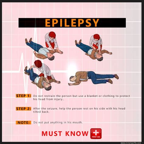 Epilepsy First Aid Tip