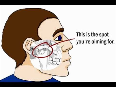 George dillman explains the technique of. How to Fight - Devastating Pressure Points - YouTube