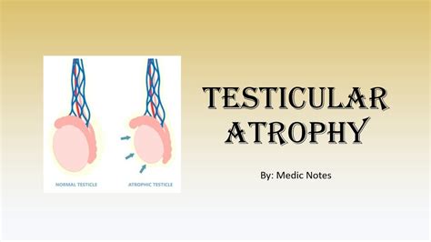 Mechanism And Different Causes Of Testicular Atrophy Klinefelter