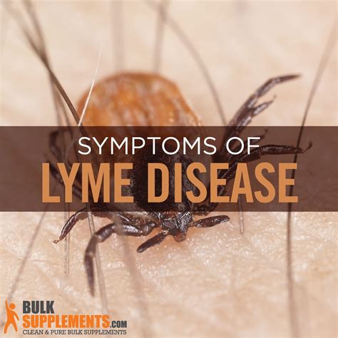 Lyme Disease Symptoms Causes And Treatment By James Denlinger Medium