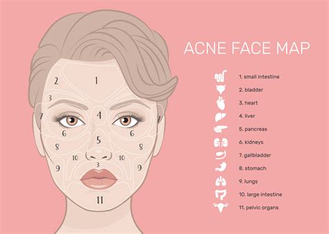 How To Manage Acne Prone Skin