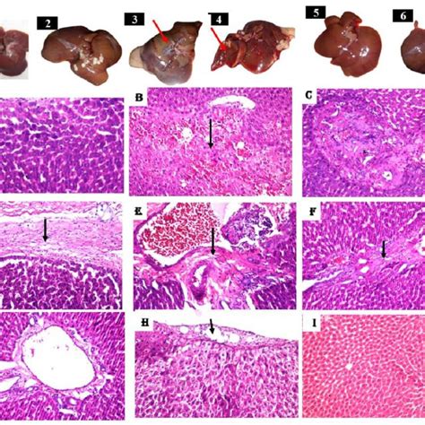 Gross Pathology And Histopathological Examination Of Livers Tissues By Download Scientific