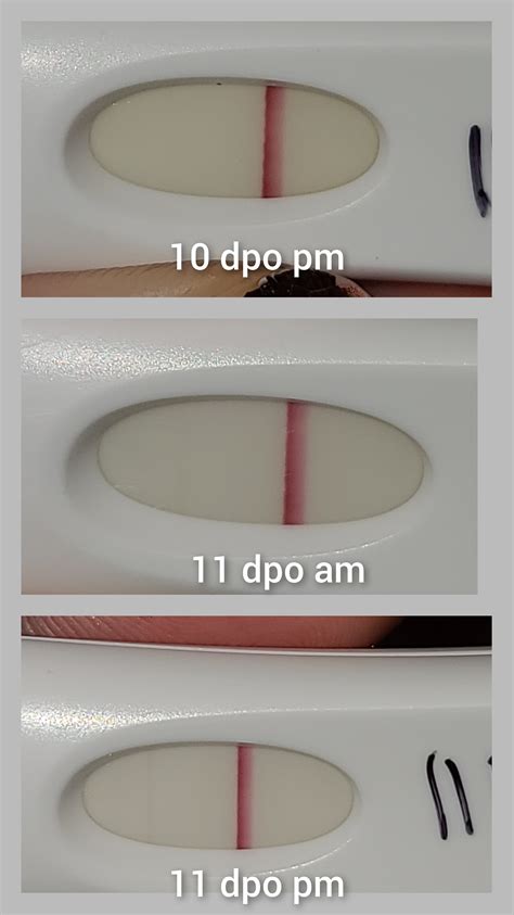 11 Dpo Frer I Got These Lines On At 10 Dpo Pm 11 Dpo Fmu And 11 Dpo