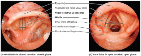 Epiglottis Anatomy Location Function And Epiglottis Infection