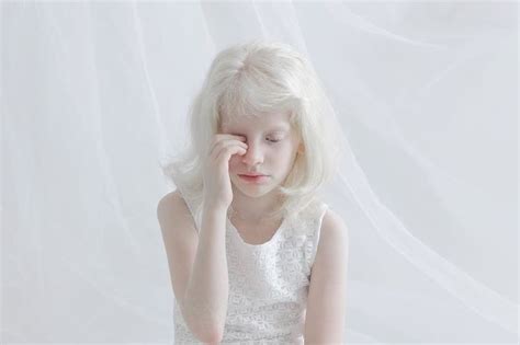 Photographers Capture The Unique Beauty Of Albino People And People