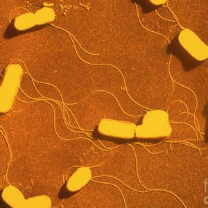 Listeria Monocytogenes Bacterium Photograph By Dr Kari Lounatmaa