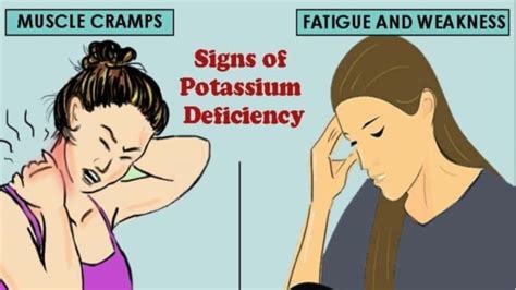 8 signs and symptoms of potassium deficiency hypokalemia symptoms of low potassium youtube