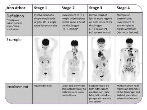 Fdg Petct In Staging And Response Assessment In