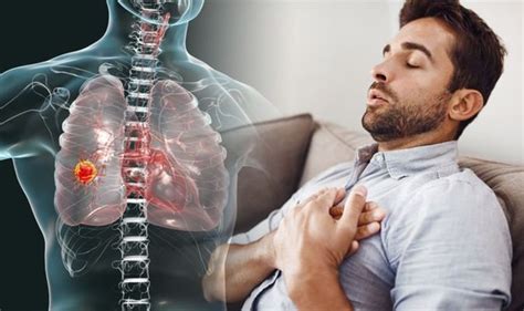 Lung Cancer Symptoms Recurring Chest Infections Could Be A Sign