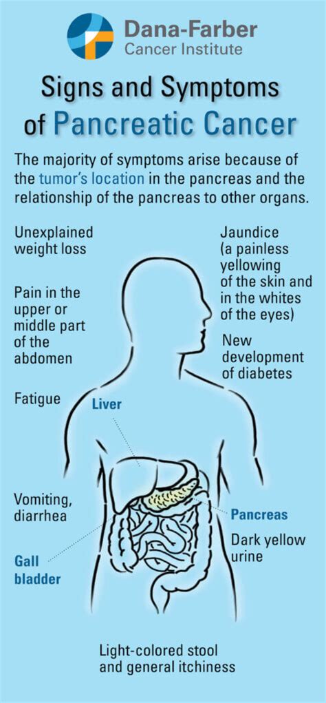 Pancreatic Cancer Symptoms Dana Farber Cancer Institute