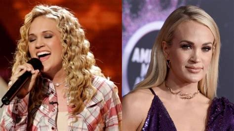 ‘american Idol Carrie Underwoods Plastic Surgery Scar Accident
