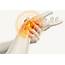 Pain Management For The Hand & Upper Extremity  Occupational Therapy