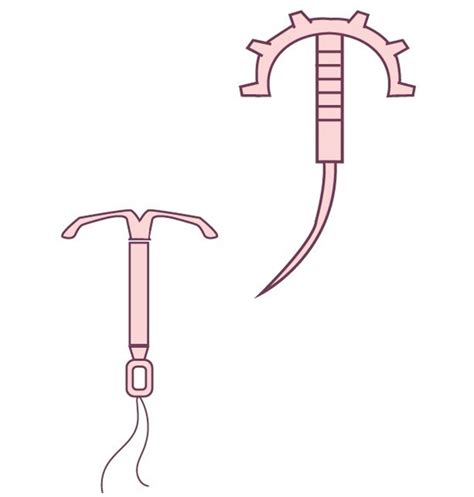 子宮内避妊具（iud・ius）の違いと避妊効果や装着方法について｜ピル処方の病院なび