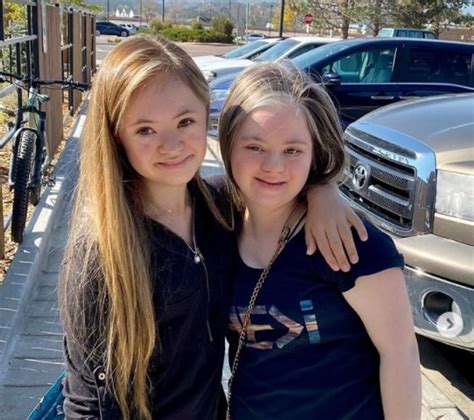 a girl with down syndrome beats doctor s odds and grows into a stunningly beautiful model