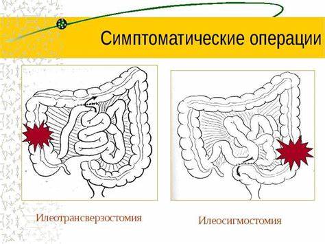 Ободочная Кишка Операция Диета — Похудение Диета Правильное Питание Картинка - Ободочная Кишка Операция Диета — Похудение Диета Правильное Питание