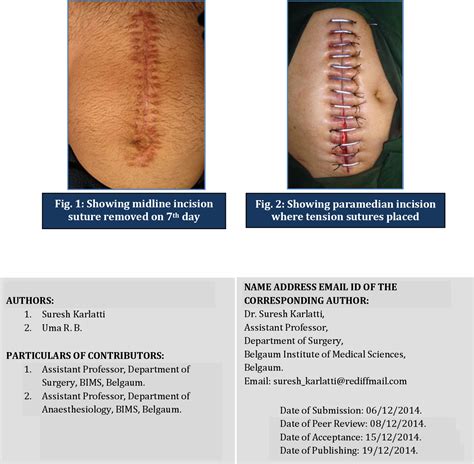 Figure 1 From Comparative Study Between Midline Incision Over